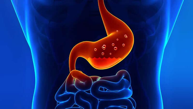 Disa Këshilla si të Normalizoni Acidin e Stomakut